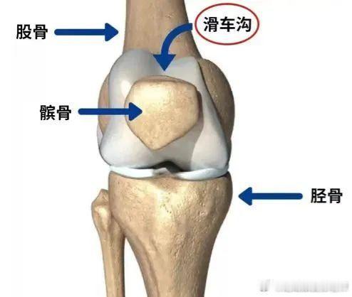 #髌骨软化症# 之前讲髌骨软化，提到高位髌骨是髌骨脱位的重要诱因，那有人问：有“