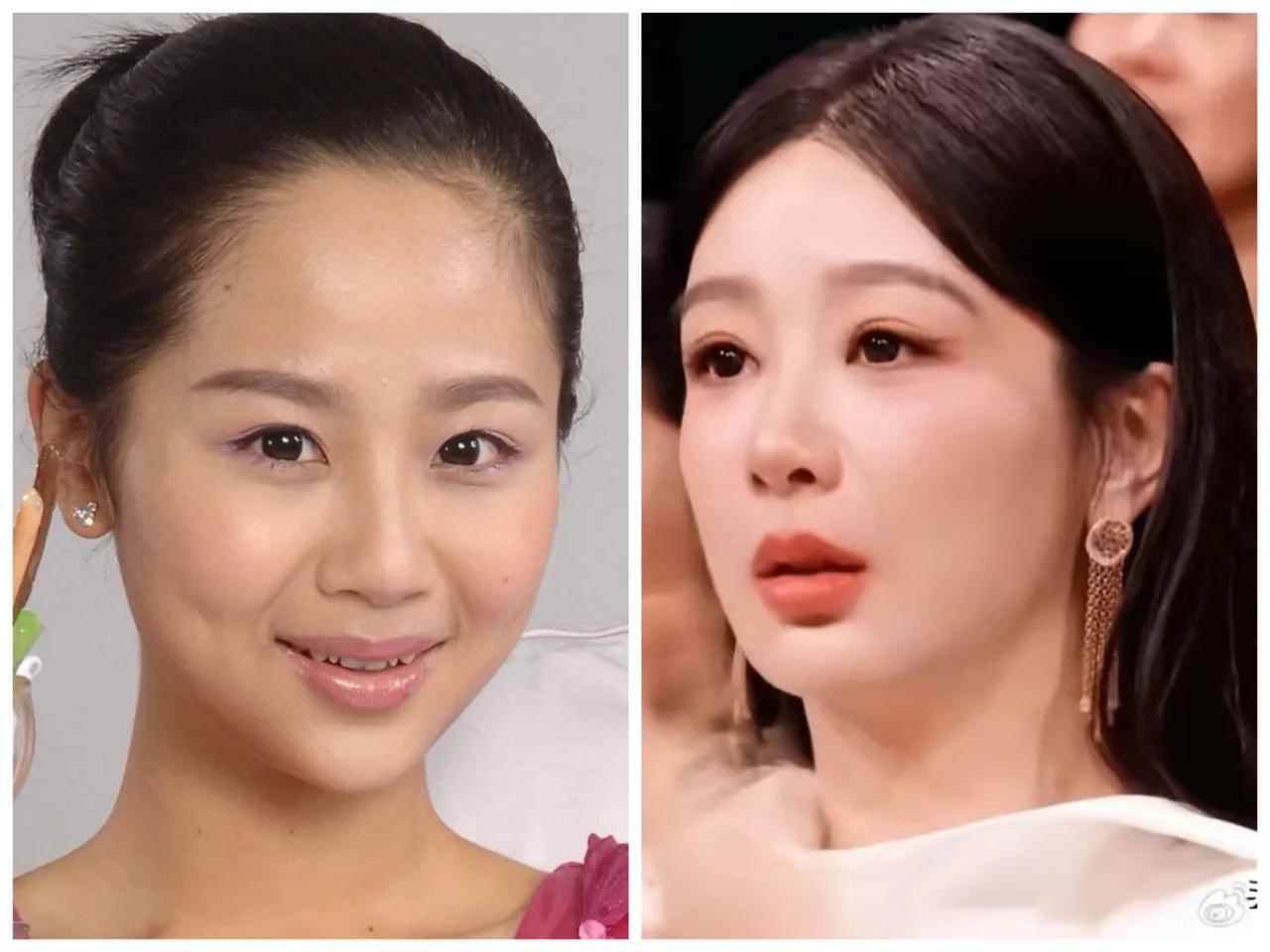 杨紫这几年变化挺大的，特别是脸，原来精灵古怪的，现在变成搭了了，没有一点活力了。