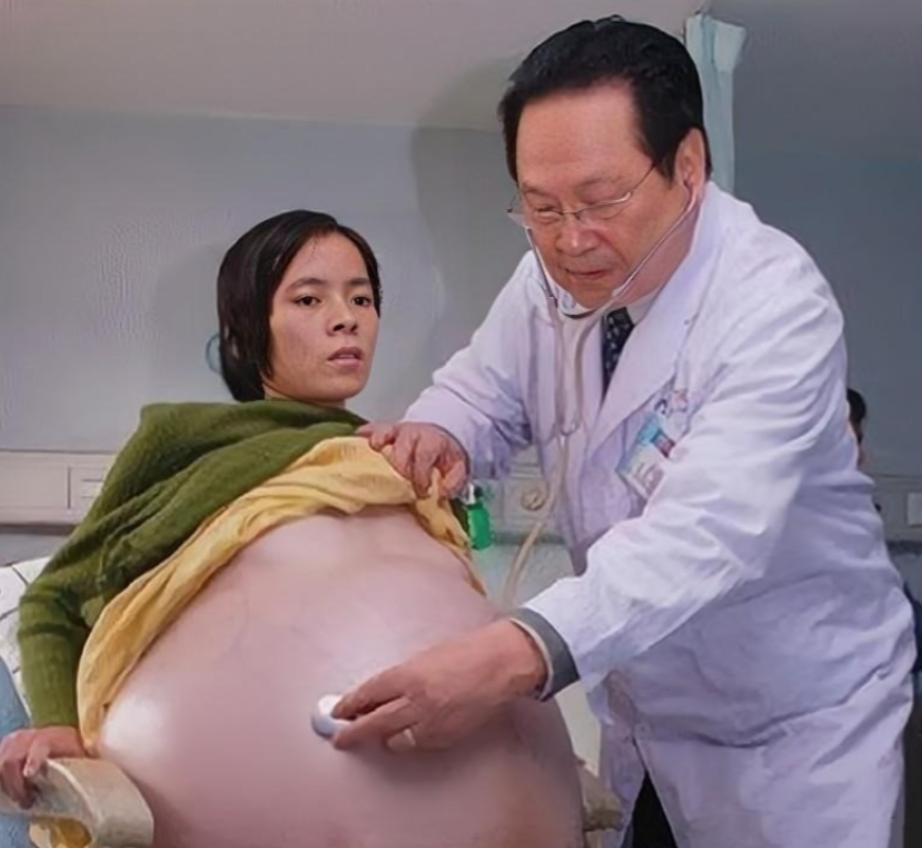 2007年，怀胎12个月的女子，在丈夫的陪同下，挺着巨肚，来到了广州医院检查，没