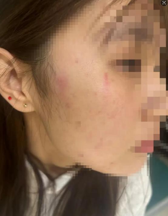 山东东营，18岁的女孩，独自在家被陌生人敲门，门打开后，对方称自己的儿子被女孩的