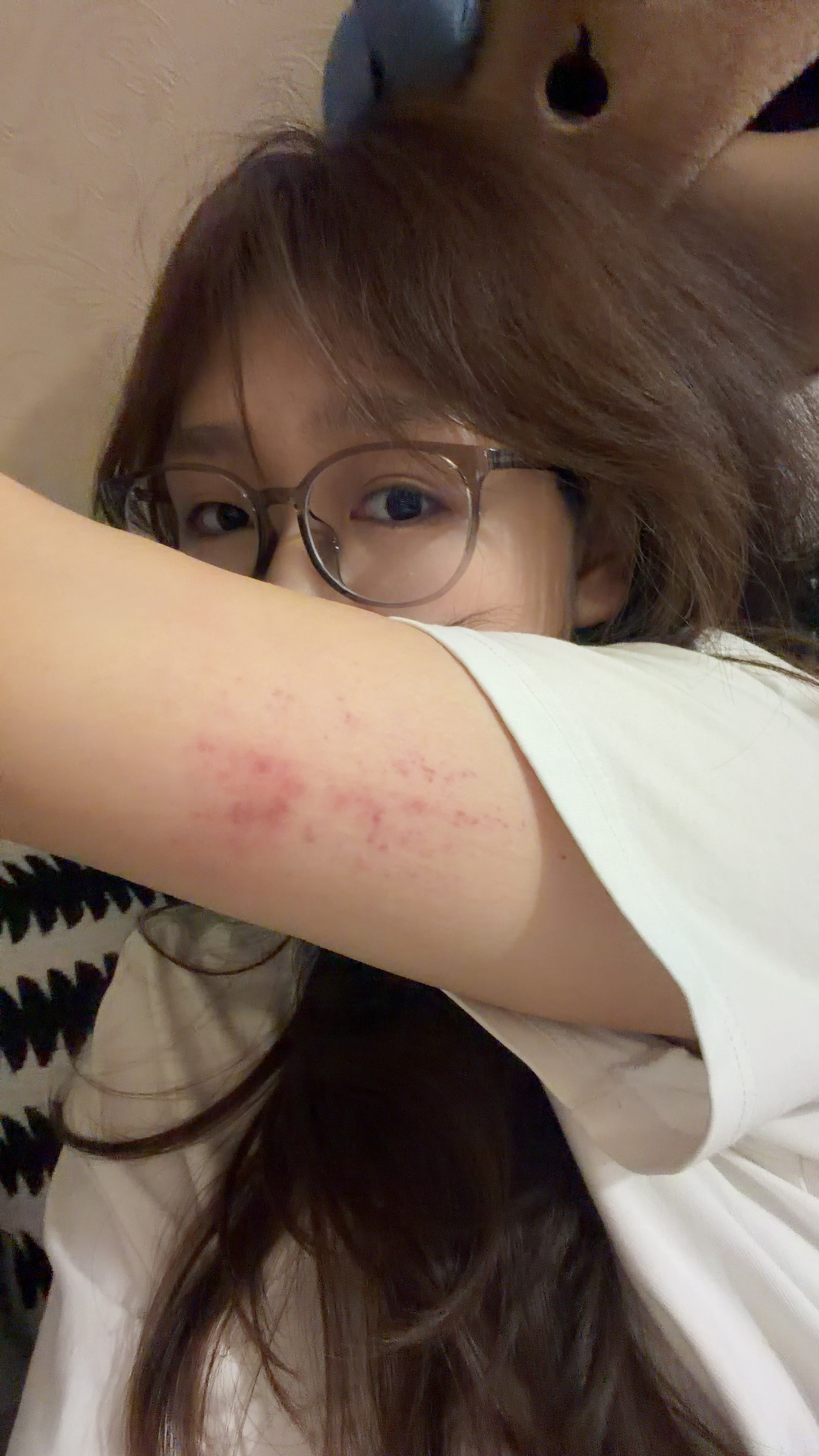 深圳的蚊子真的太狠了… 