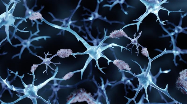 【FDA批准阿尔茨海默症血检技术】富士瑞必欧生物诊断公司与罗氏控股联合研发的阿尔