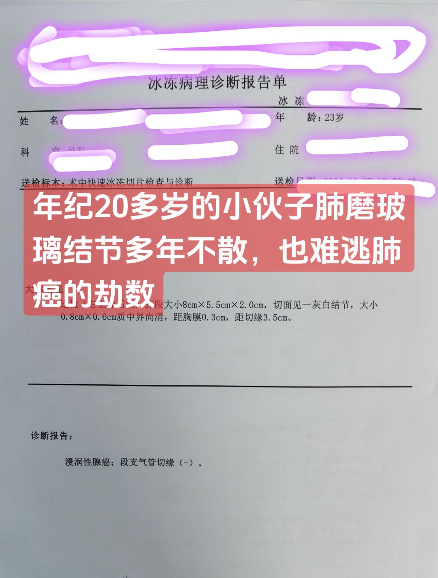 年轻人也不可忽视肺癌。这是一发现半年多的肺磨玻璃结节，考虑小伙子年轻...