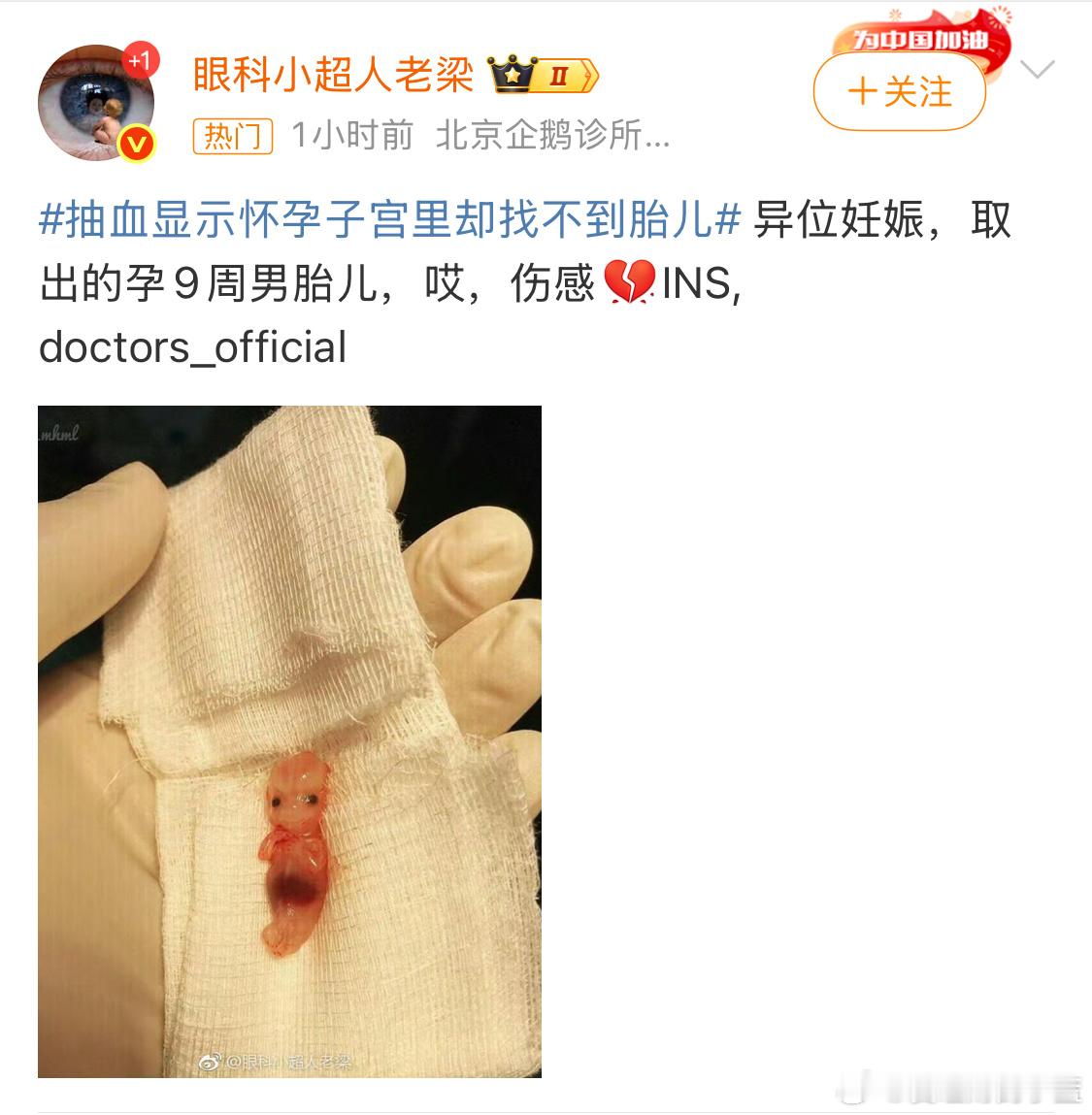 抽血显示怀孕子宫里却找不到胎儿孕9周胎儿相信绝大多人都没看过。这么小是怎么看出男