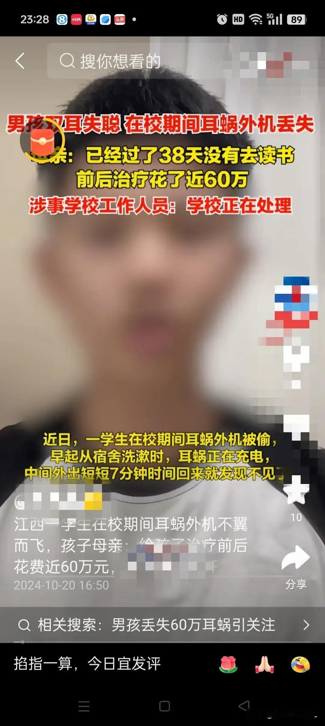 《15 岁男孩的无声困境：丢失 60 万人工耳蜗，命运何去何从？》
 
“生活就