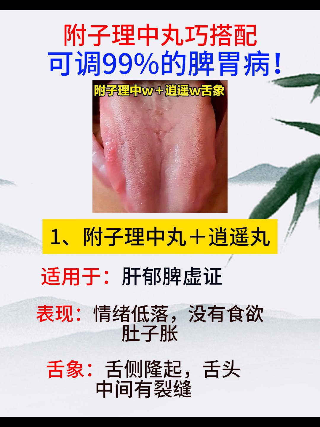附子理中丸巧搭配，可调99%的脾胃病[谢谢][谢谢][谢谢]