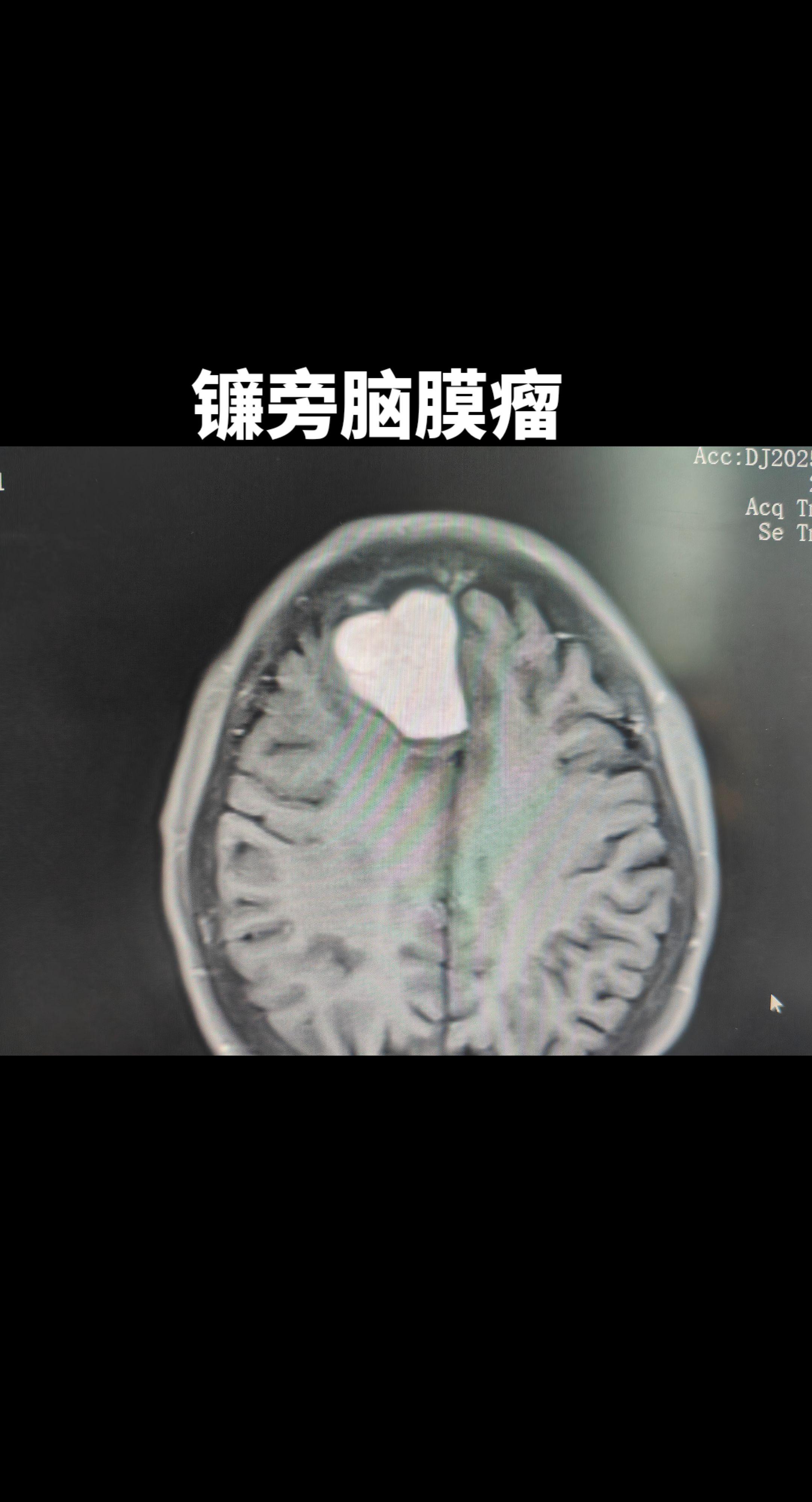 日常分享 原创视频 医学影像 医学科普