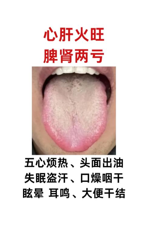 3 类核心舌象证型，中医辨证调理