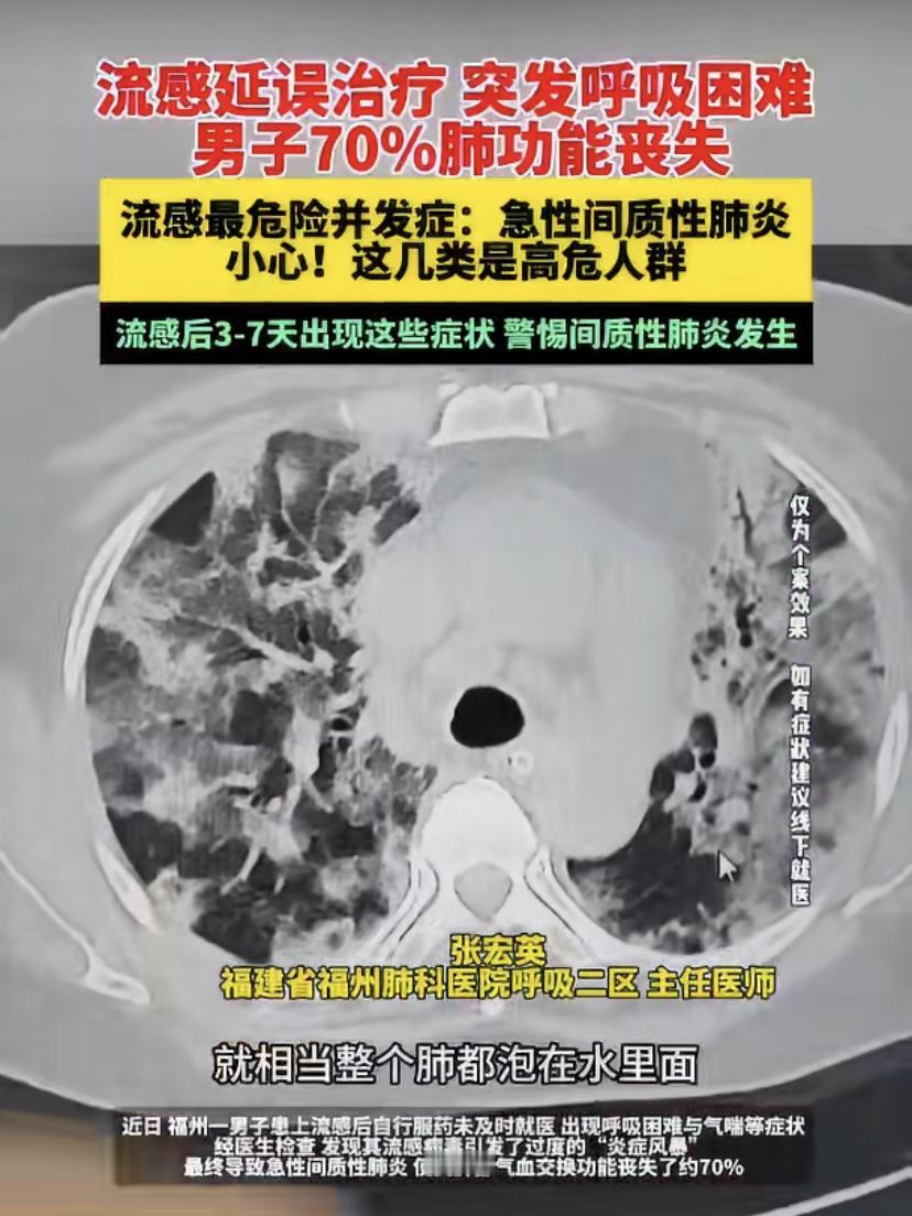 最近，福州有位大哥得流感后，自己在家吃药硬扛，结果拖到喘不上气才去医院。检查发