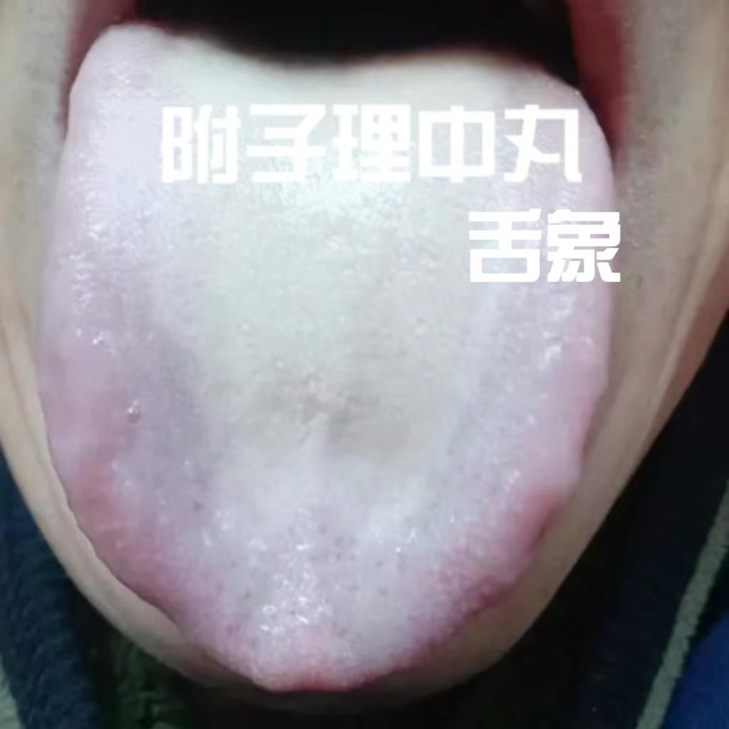 千万别再盲目服用附子理中丸了！我来告诉你为什么
 
附子理中丸由附子、干姜、人参