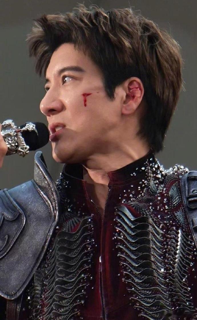 王力宏好深的伤口王力宏太拼了 这伤口不及时处理要留疤。 