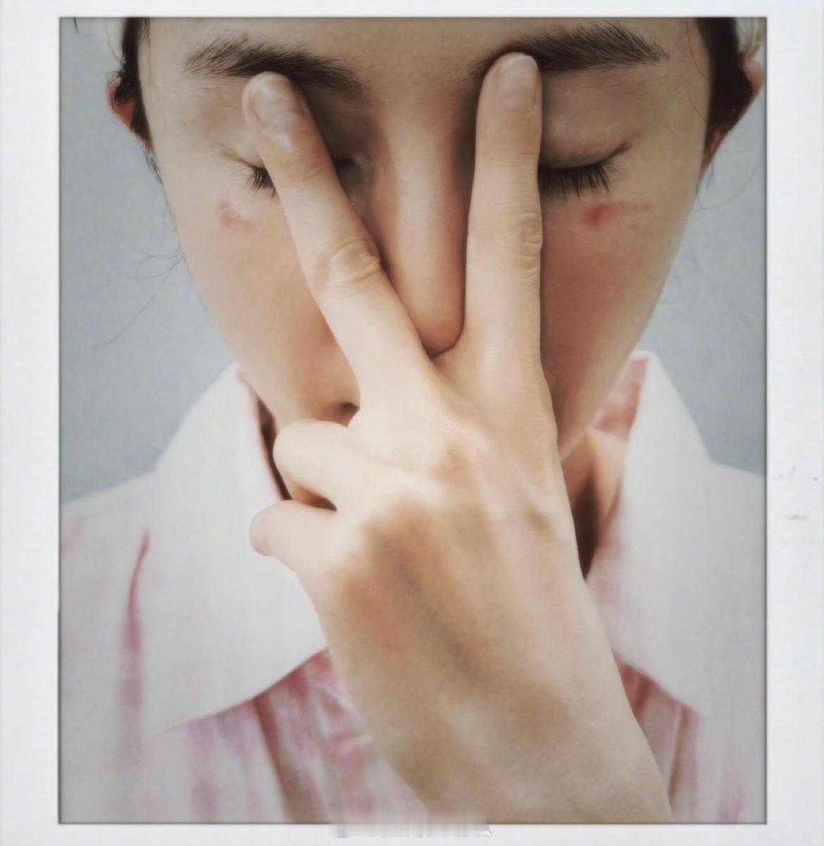 杨幂脸被蒸汽眼罩烫伤了那是我咬的杨幂