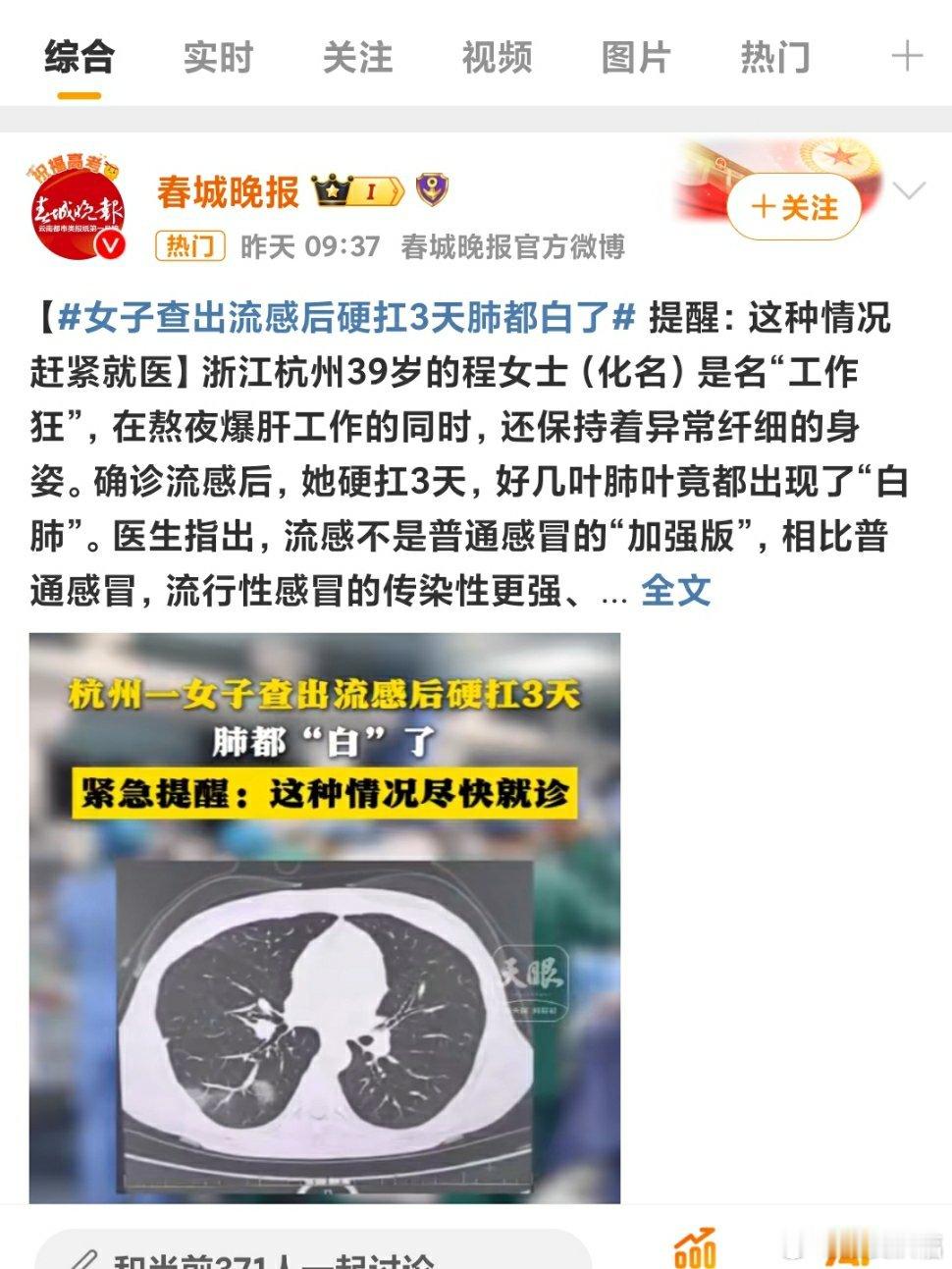 女子得了流感硬抗3天变白肺 悲剧了[允悲]一定要注意预防，早诊断早治疗早康复，莫