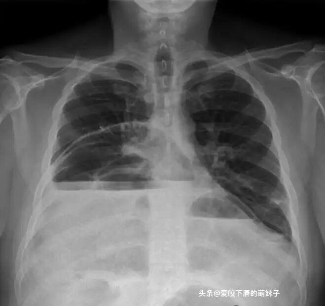 有懂医的吗？帮我看看谢谢🙏