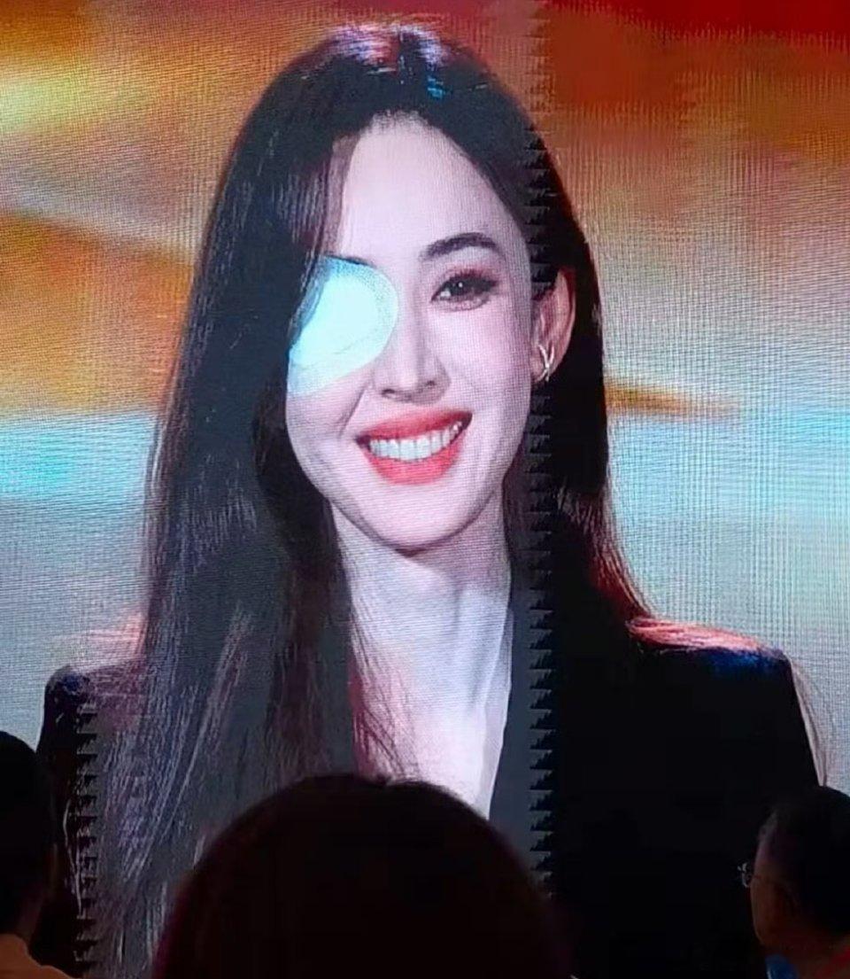 娜扎右眼贴纱布啊啊啊啊啊美女咋了