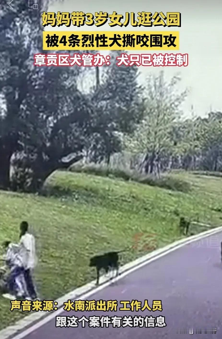 母女都被咬成这样了，为啥不先控制狗主人？是人权大还是“狗权”大？

我住的单元，