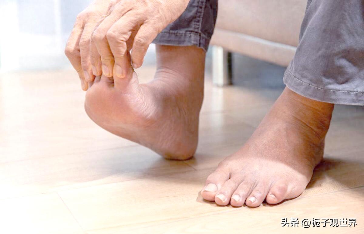 老年人腿抽筋有什么特点？发作时居家紧急处理方法？预防措施有哪些？
       