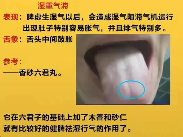 你是否常常感到食欲不振、消化不良？这可能是你的脾胃在悄悄虚弱。今天，我们就来聊聊