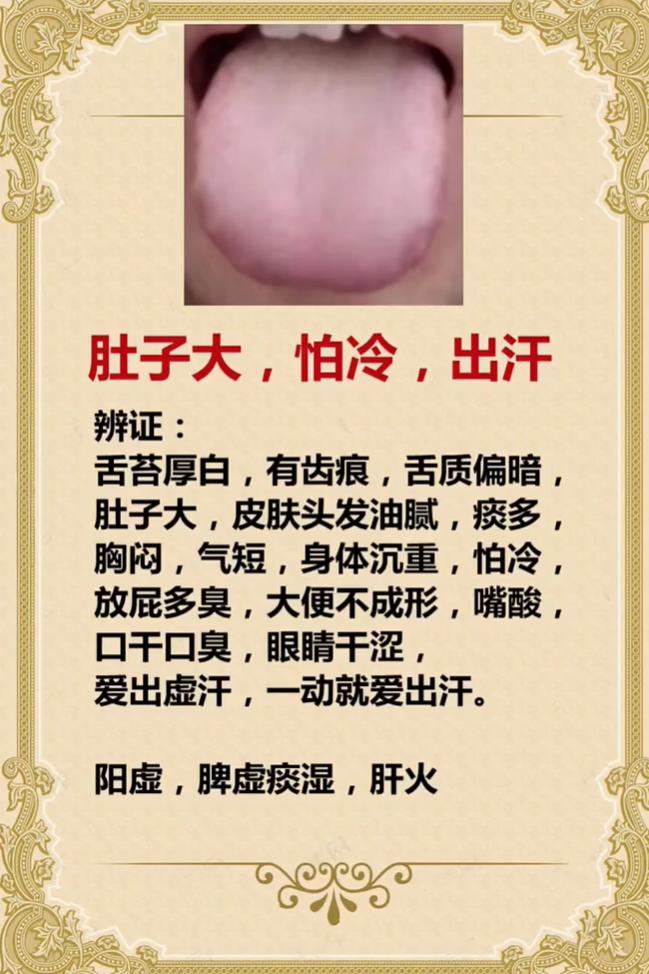肚子大、怕冷还爱出汗？多半是阳虚、脾虚痰湿、肝火偏旺