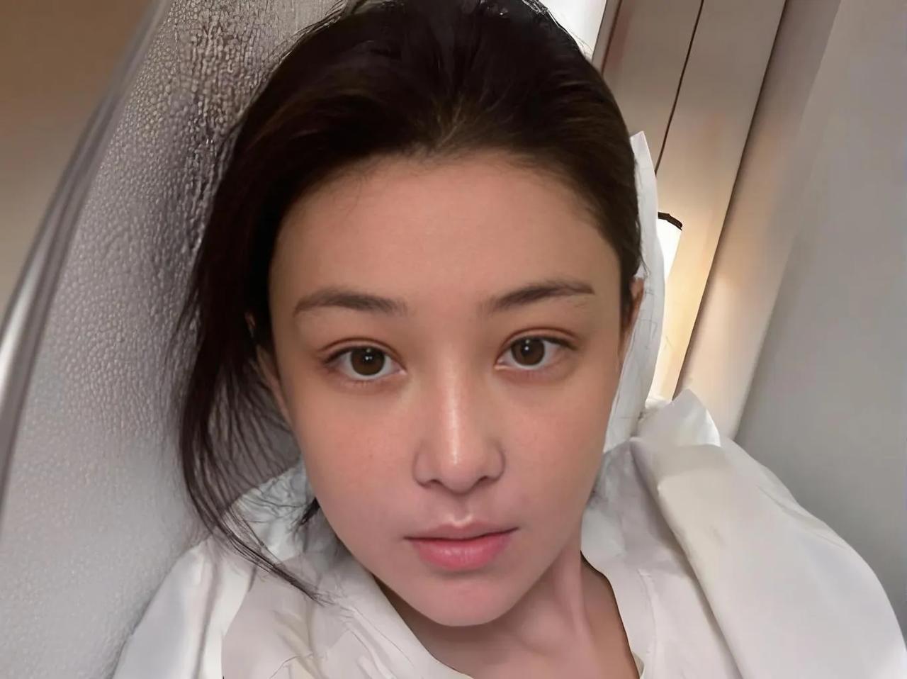 张馨予斑秃引关注，健康话题再受热议

近日，演员张馨予在社交媒体上自曝患上斑秃，