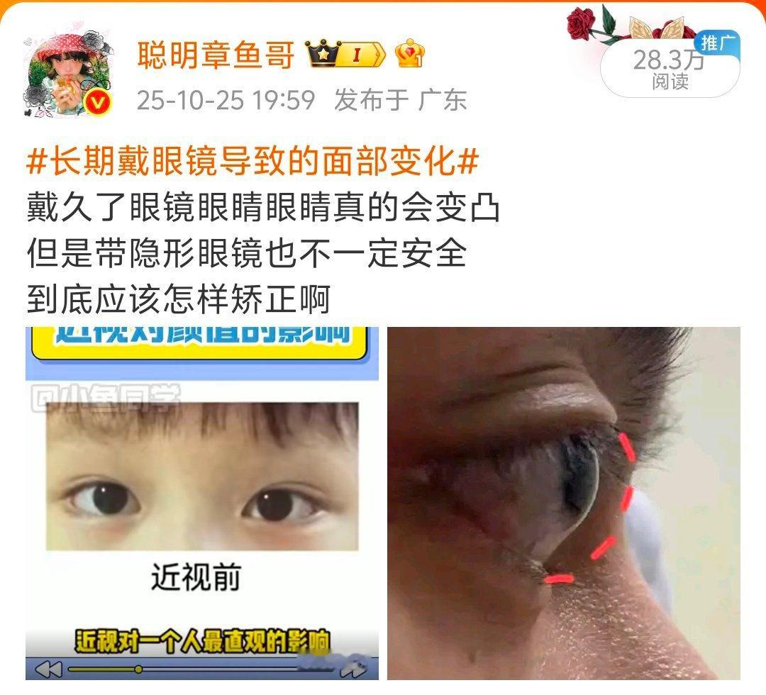 我兴奋过头才看见，丈育一个眼睛眼睛是什么鬼[费解] ​​​