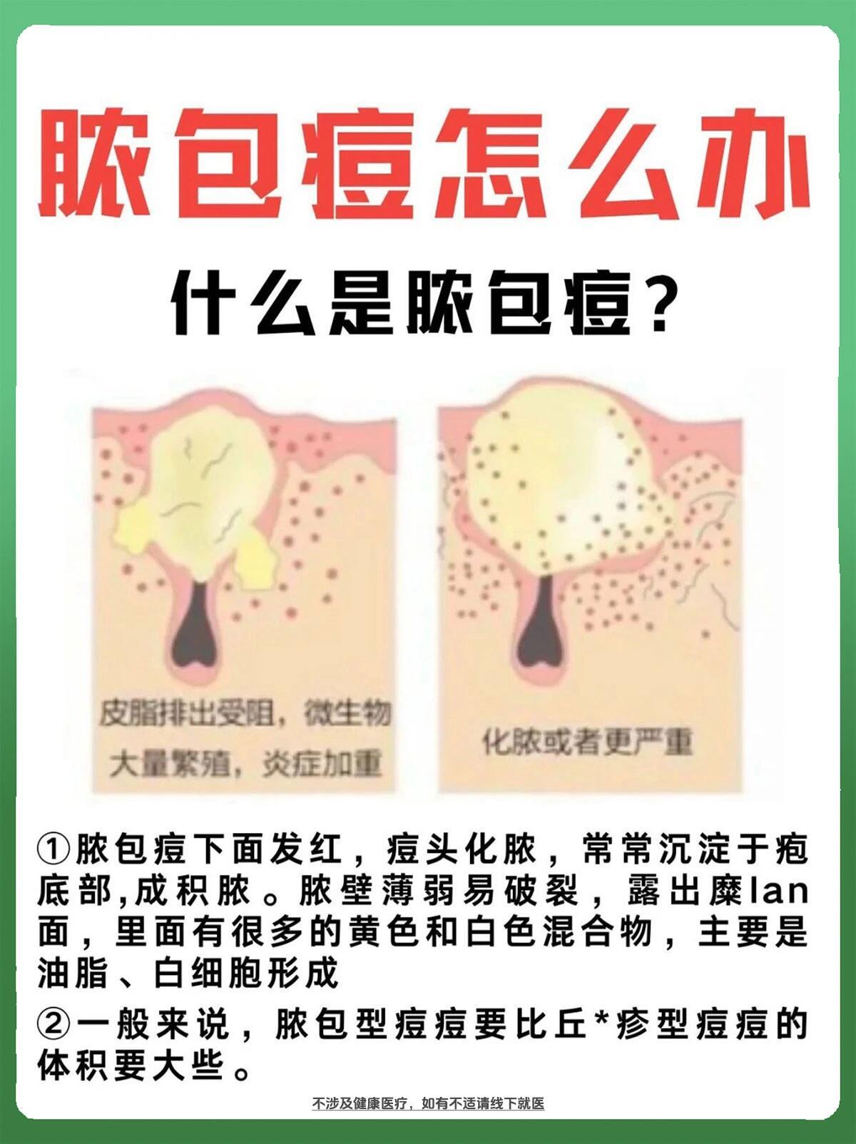 怕留痘印不要慌，三步告别脓包痘。痘痘发炎红肿挤痘痘