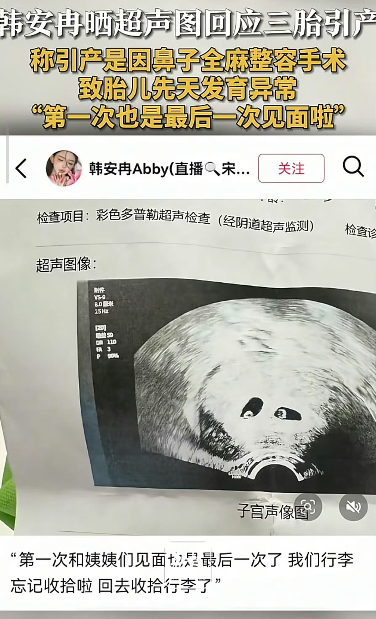 曝韩安冉11月做了人流手术怀孕 7次，生 2 次，打 4 次，现在又流一次了这样