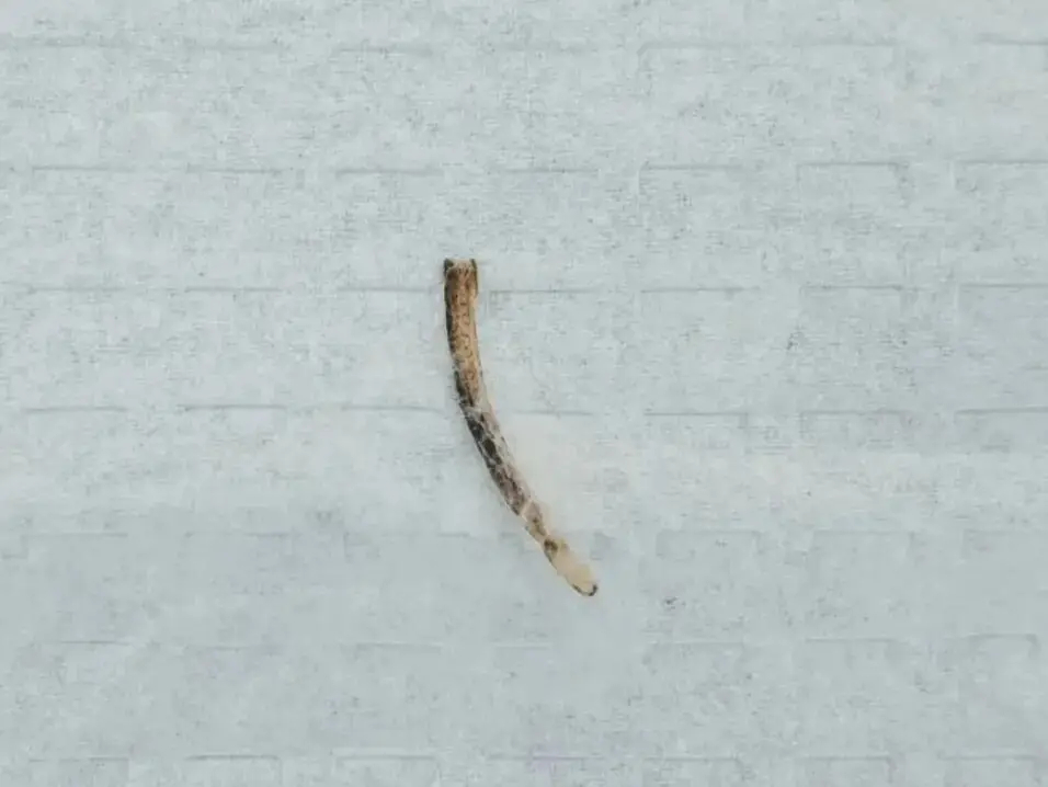 男子鱼刺卡喉几天后竟卡在肛门【太痛了！郑州男子吃鱼时鱼刺卡喉咙，几天后竟卡在肛门