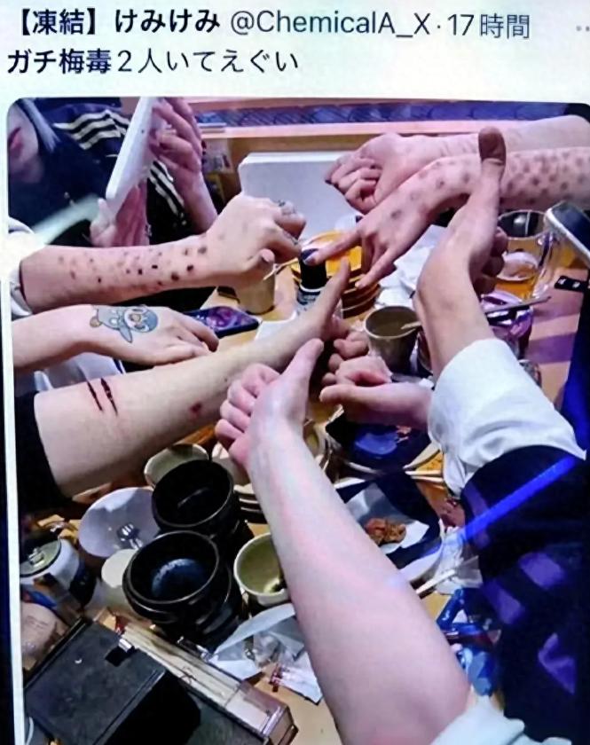 梅毒感染人数连续3年破纪录！东京彻底沦为欧美男性乐园，年轻人甚至把梅毒当做潮流，