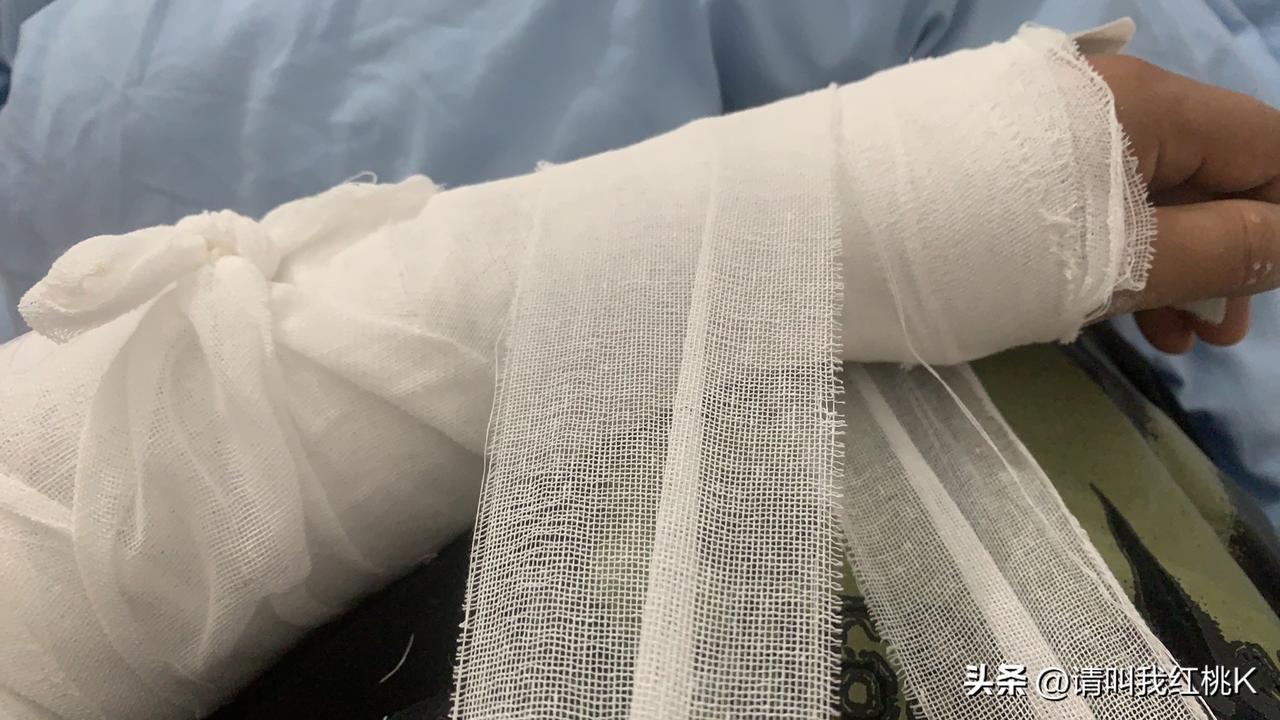 2026最想实现的一件事2025不小心摔断了小手，希望2026顺顺利利，[呲牙]