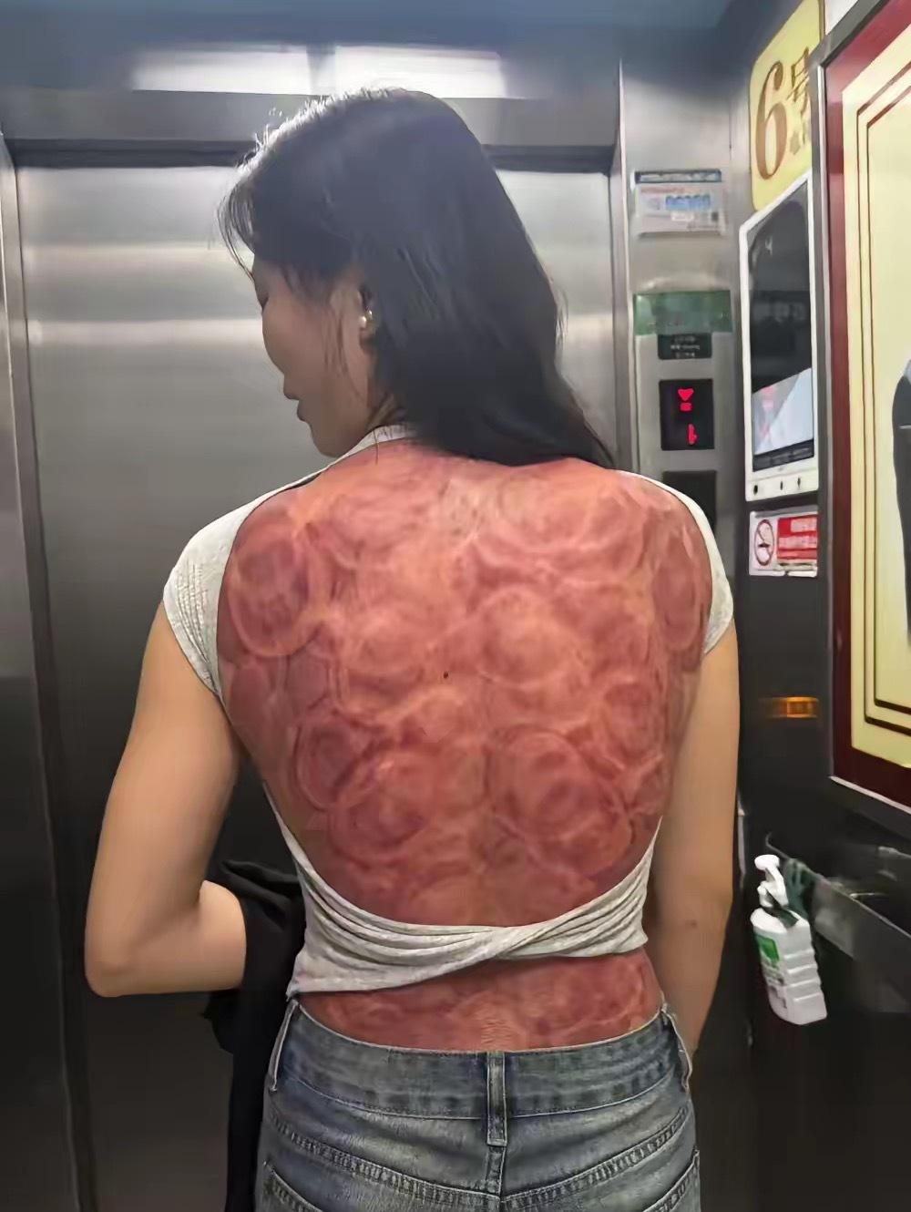 这要湿气有多重才能拔成这样。 