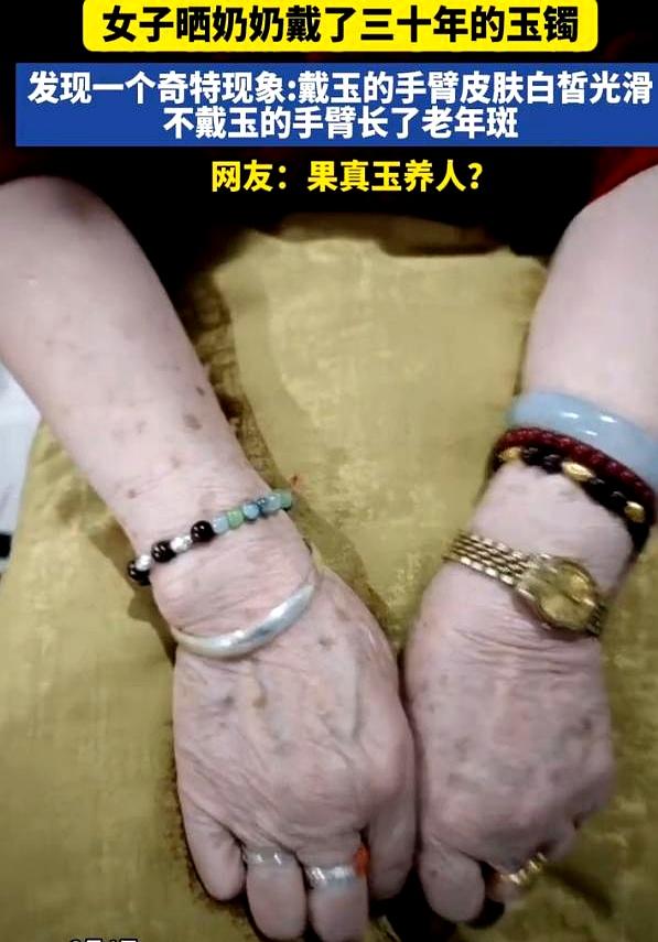 这下解释不清了！
云南一女孩回家闲聊，惊见奶奶戴了三十年玉镯的那只胳膊光滑几乎无