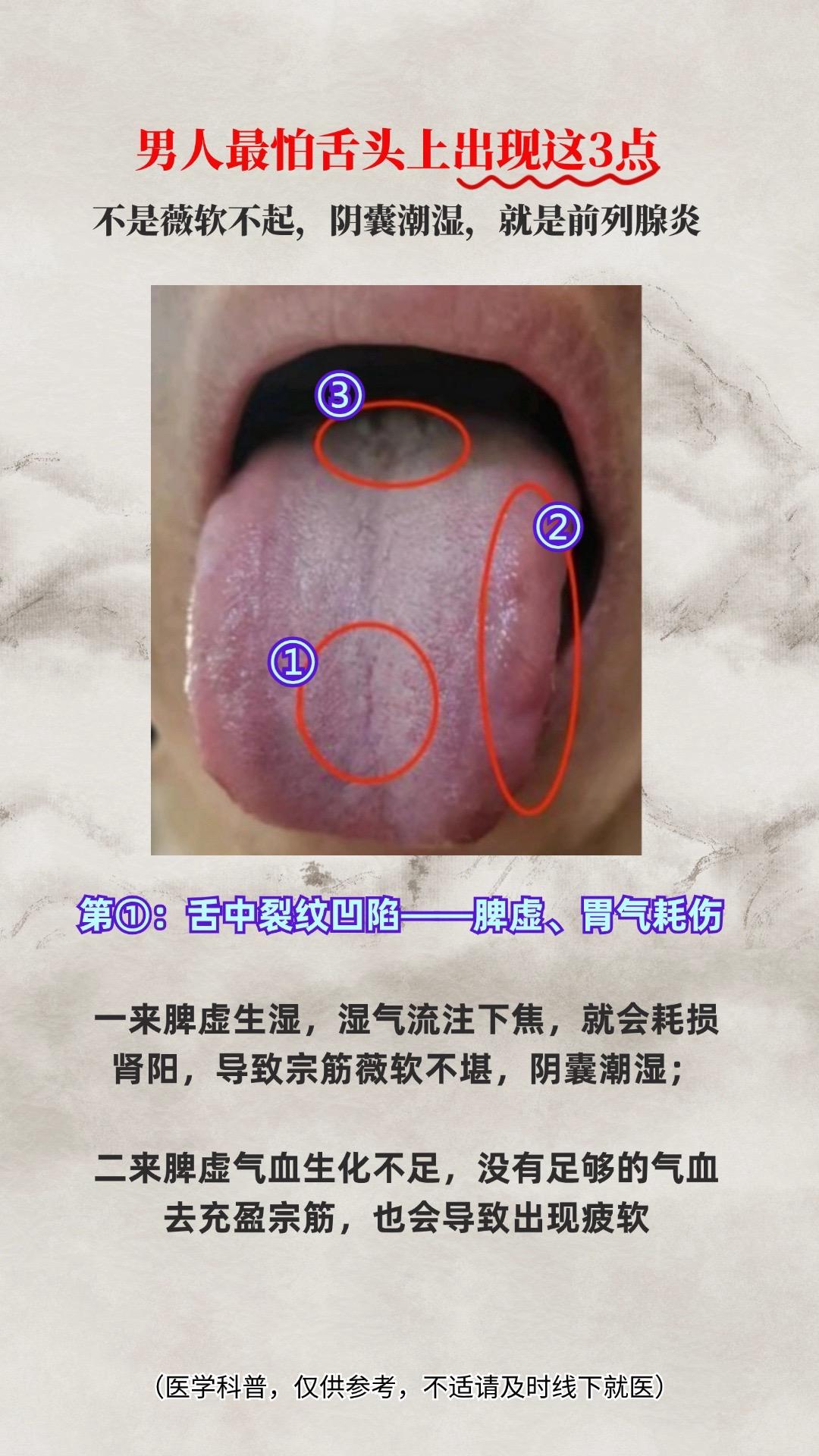 你占了几点？#中医 #舌诊 #中医养生 #每天跟我涨知识 #调理身体