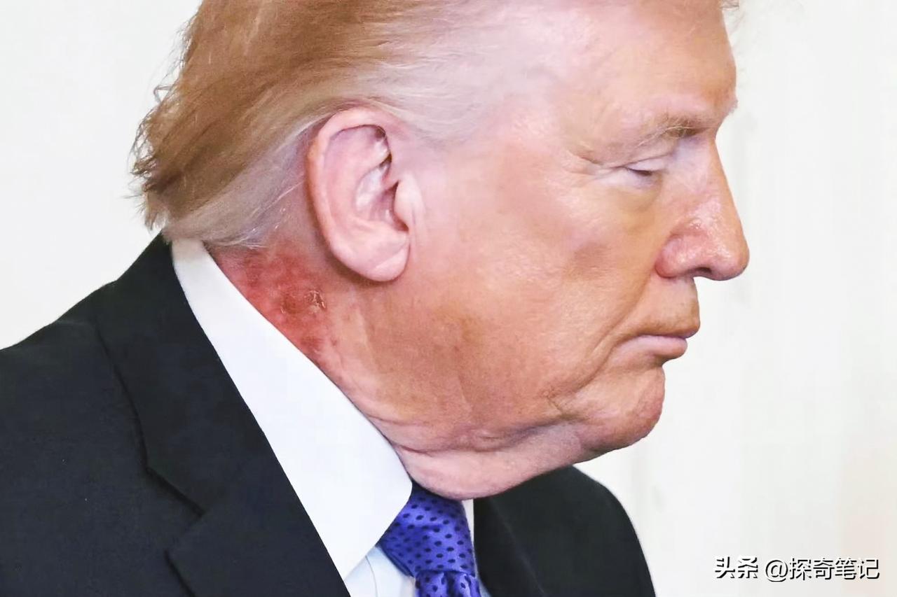 这个不安分的老头脖子上这又红了一块，照片网上传得到处都是。有热心的网友在别人的嘴