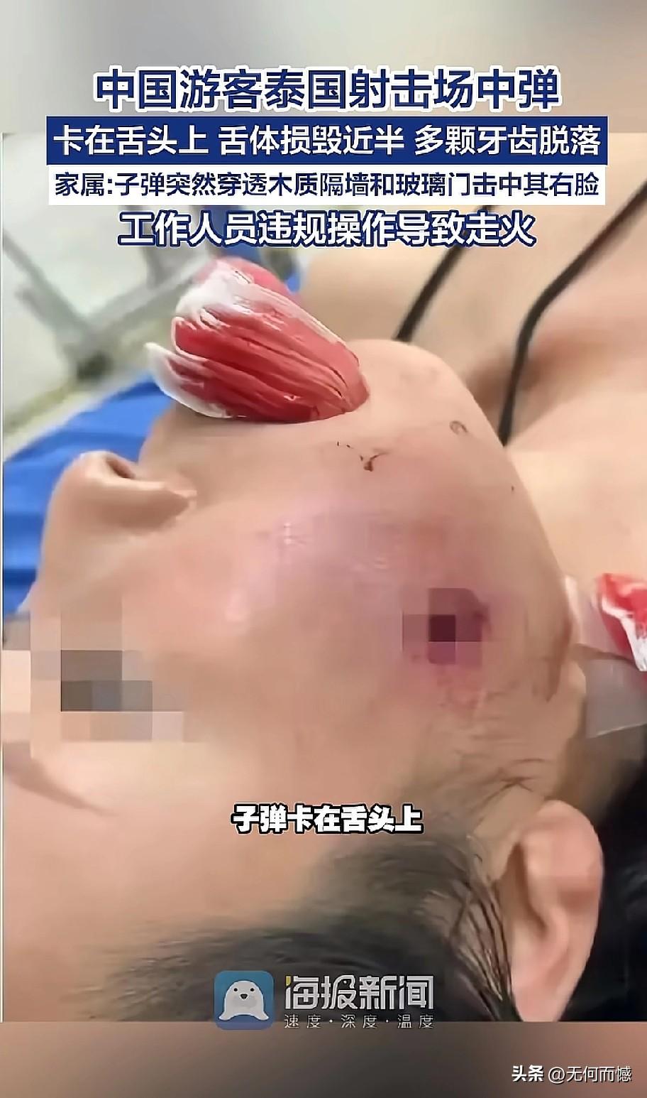 女子到泰国游玩，游没了半个舌头！那么这个女子的半企舌头是怎么游没的呢？原来是在射