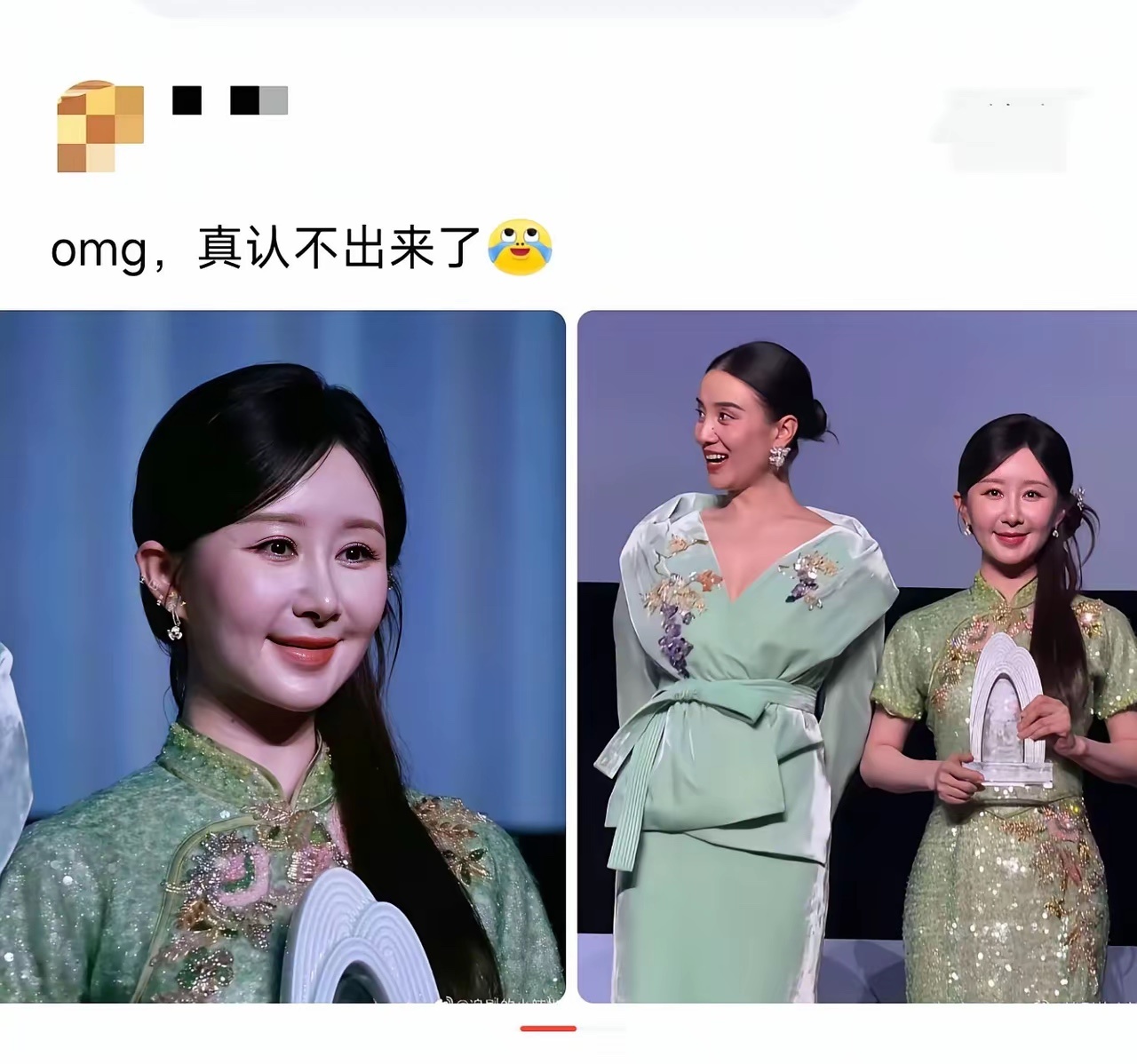 这是做了医美吗？都不认识了 ​​​