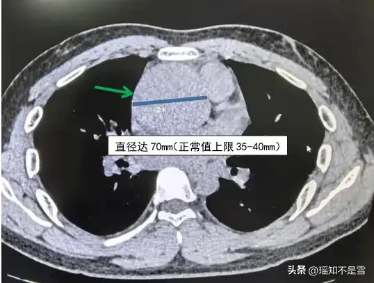“这医生火了！”湖南长沙，一19岁小伙在家中咯血，去医院做完CT后便回了家，医生