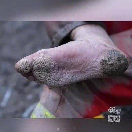 吉隆救援人员泡皱的双脚令人心疼辛苦了，英雄！  ​​​