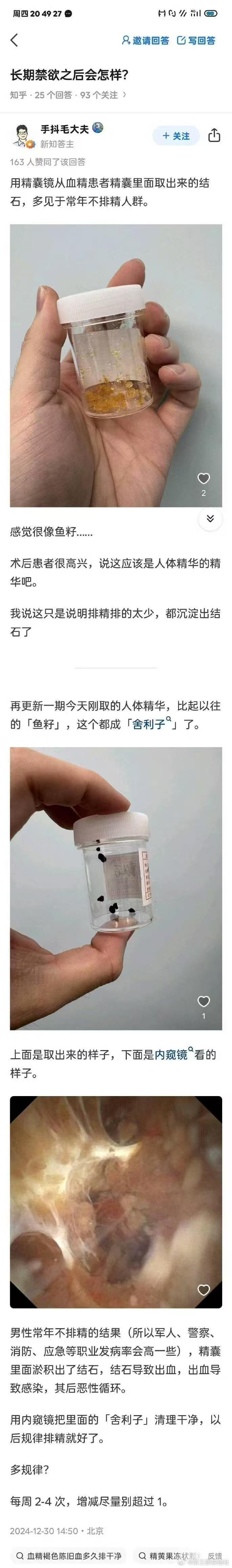 金丹期 ​​​