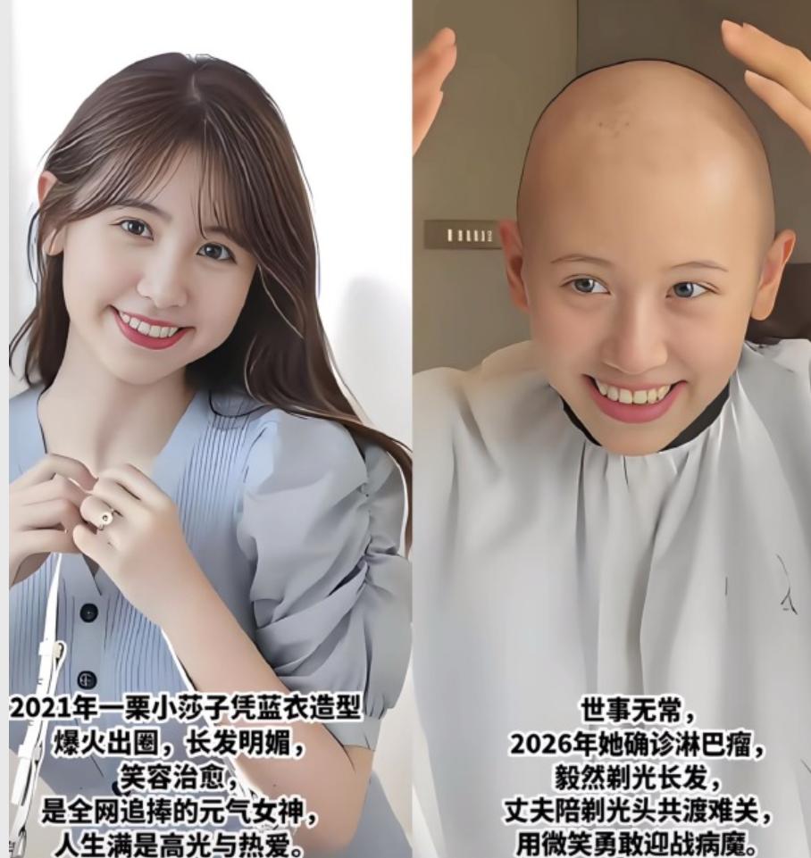 生病不可怕，怕就怕没钱治

唯一幸运的是她很有钱

她今年年初确诊的是经典型霍奇