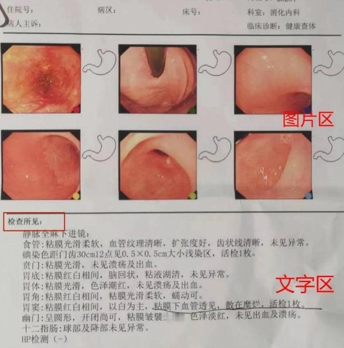 胃镜报告中没有这五个字眼，说明你的胃没有大问题

大家好，我是你们的医生朋友宋金