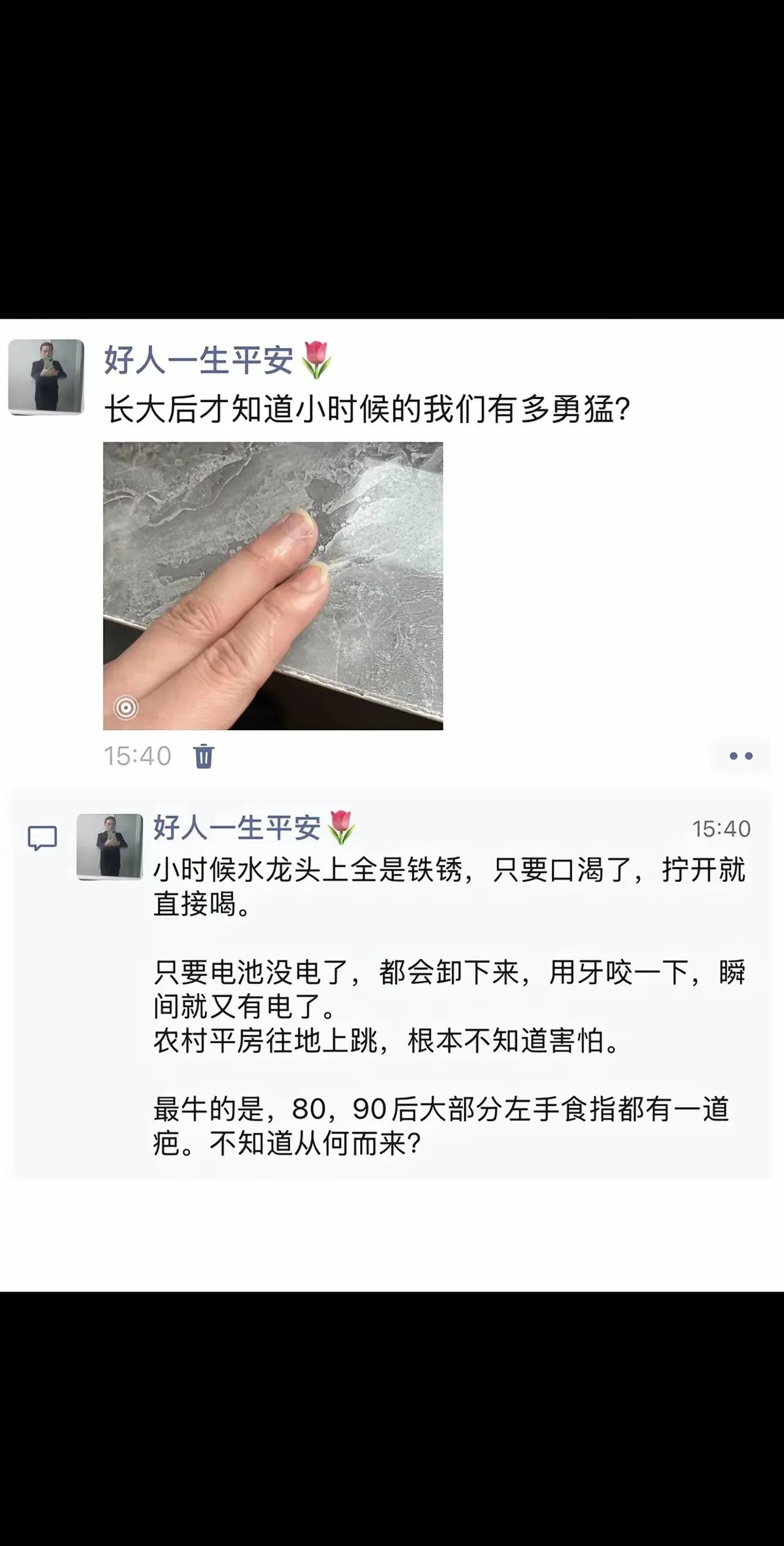 好像好多人的左手食指都有一道疤，我也有，这是怎么回事？我没记得手受过伤呢？