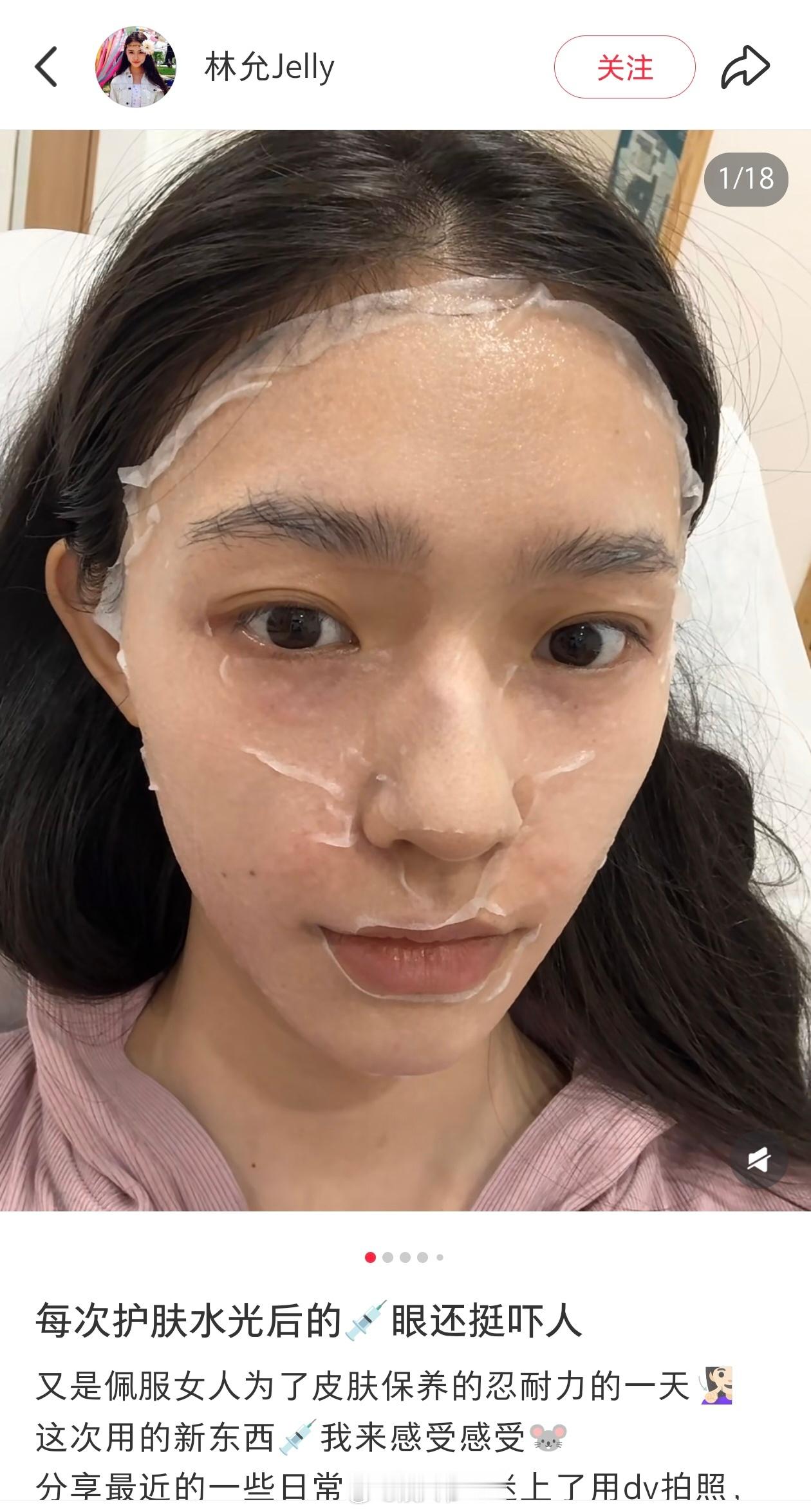 韩安冉曝杨幂杨紫鞠婧祎林允整容了林允医美一直都有在大大方方的说，还挺拉好感的 