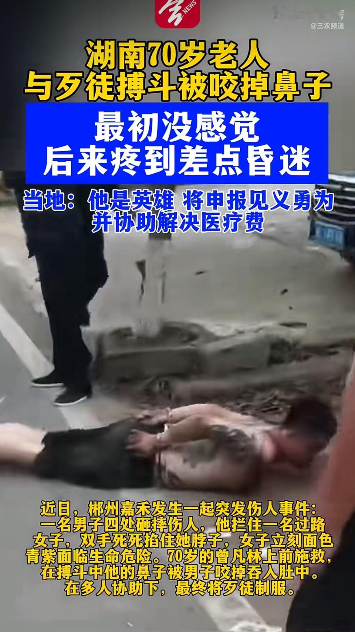天呐！70岁老人见义勇为救被掐脖子的女子，鼻子被歹徒整个咬掉吞进肚子，结果获救的