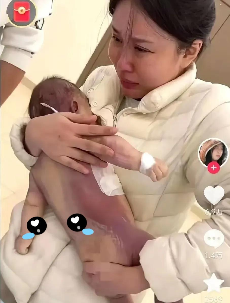 5个月洛熙宝宝手术去世的事，
给所有母亲们敲响了警钟
5个月大的女婴
医生告诉家