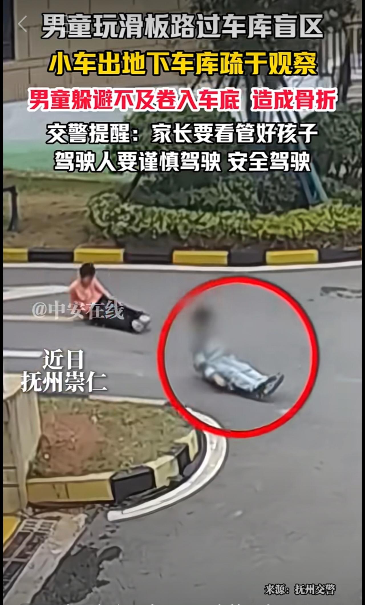 近日抚州崇仁，男童玩滑板路过车库盲区，小车出地下车库疏于观察，男童躲避不及卷入车