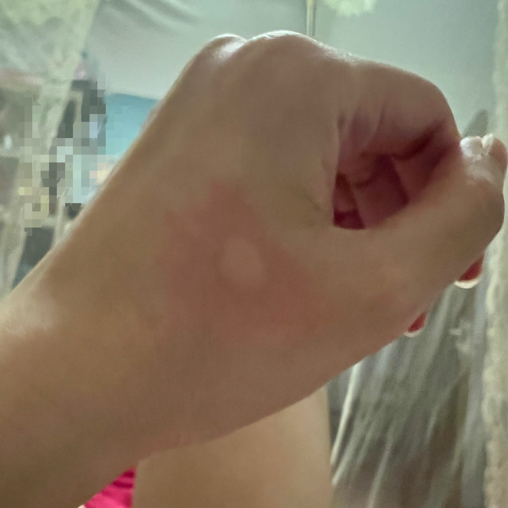 后半夜被蚊子咬醒了，打了三只蚊子都没有血，愣是不敢睡了，到早晨迷迷糊糊刚睡着就该