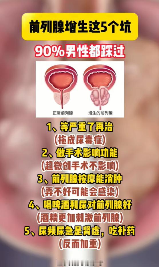 腺体增生五大误区，多数男士都曾踩坑