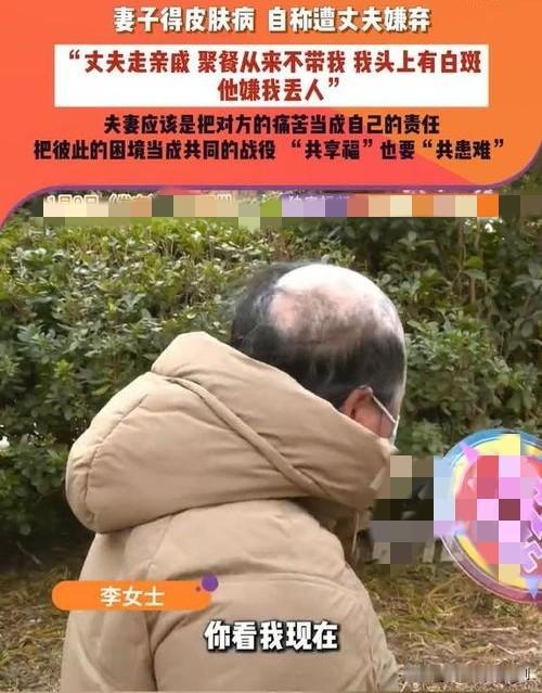 患病女子似裘千尺，惨遭丈夫“抛弃”

女子患病两年，病情使她容貌大变，形似《神雕
