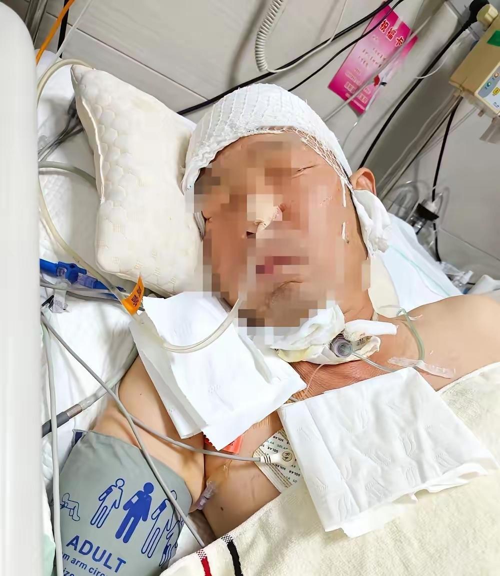 太心酸了 同门二婶硬扛着骂名做了最难的决定
 
二叔脑淤血躺ICU七天 医生说继